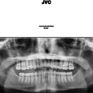 JVC (New LP)